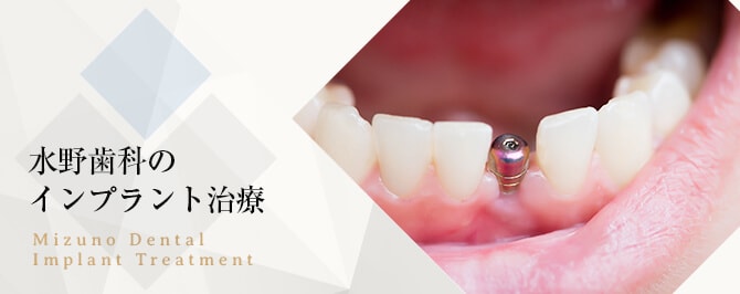 水野歯科のインプラント治療